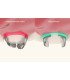 نوار ماتریس (6914)Polydentia- Unica Proximal anterior
