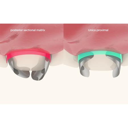نوار ماتریس (6914)Polydentia- Unica Proximal anterior